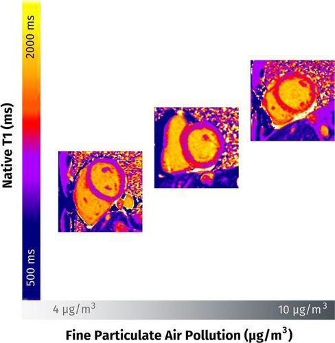 "초미세먼지(PM2.5), 심근 섬유화 유발"초미세먼지(PM2.5) 농도가 심근 섬유화(myocardial fibrosis)에 미치는 영향. PM2.5 농도가 높아지고(4㎍/㎥→10㎍/㎥) 노출 기간이 길어질수록 심근 섬유화 증상(노란색~주황색 부분)도 심해지는 것으로 나타났다. [Radiological Society of North America(RSNA) 제공. 재판매 및 DB 금지]