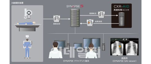 후지필름이 소개한 루닛과 적용된 인공지능 암 검사 판독 시스템 모습 (자료=후지필름)