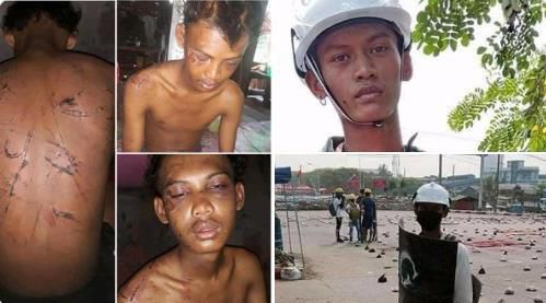 군경에 체포된 뒤 얼굴과 온몸이 상처투성이가 된 청년[트위터 @lumijuneus·재판매 및 DB 금지]