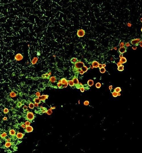 변형된 녹말 양소체 파킨슨병, 알츠하이머병 같은 신경 퇴행 환자나 고령자의 뇌에선 변형된 녹말 양소체가 많이 관찰된다.
정상인 녹말 양소체는 뇌의 폐기물 배출 용기로도 쓰인다.
[스페인 바르셀로나대 제공/ 재판매 및 DB 금지]