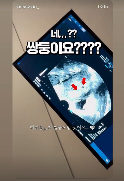 사진=김지혜 SNS