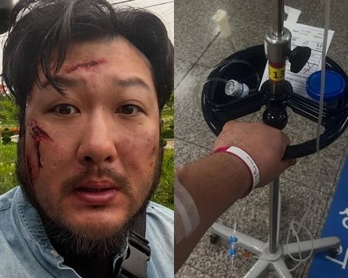 배우 김대호가 최근 말라리아에 걸린 근황을 공개했다. [사진=김대호 인스타그램]