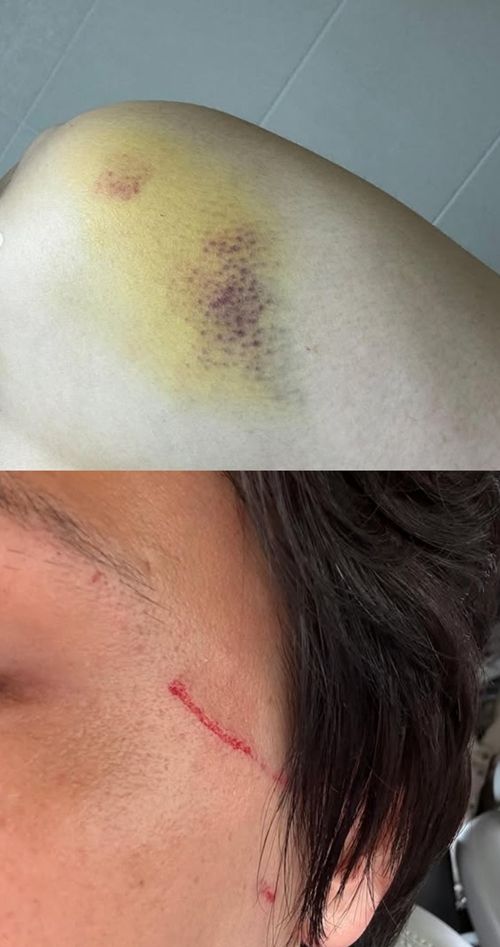 가수 은종이 가정폭력 정황이 담긴 영상을 공개한 가운데 윤딴딴이 이를 반박했다. 사진=윤딴딴 SNS