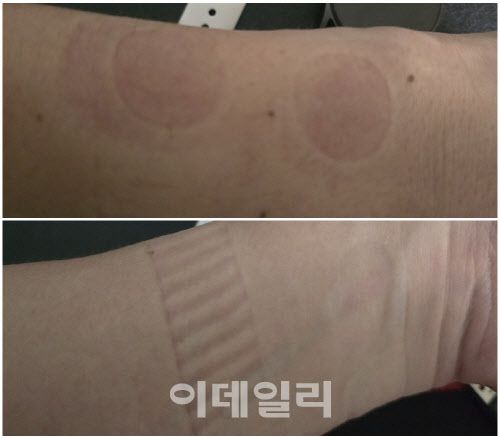 갤럭시워치7과 애플워치10을 한 시간 가량 착용하고 러닝한 이후 손목. 좌측에 밴드 자국이 선명한 것이 갤럭시워치7를 착용한 자리다.(사진=윤정훈 기자)