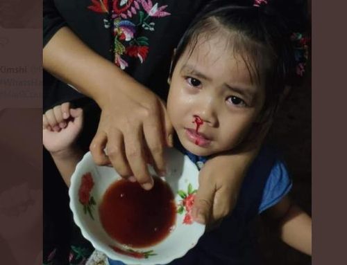 "최루탄에 눈물, 코피 쏟는 아이"[트위터 @RogerKimshi]