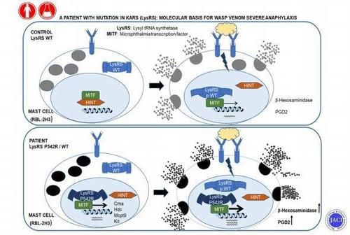 중증 아나필락시스 발생 경로 [스페인 바르셀로나대 연구팀 '미국 알레르기 천식 면역학회지' 논문 발췌/ 재판매 및 DB 금지]
