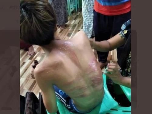 미얀마 군경에 체포됐다 풀려난 15세 소년[트위터 @KyisandarH·재판매 및 DB 금지]