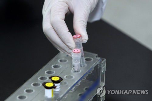 오미크론 변이, 2시간 만에 확인(광주=연합뉴스) 정회성 기자 = 29일 광주시 보건환경연구원 분자생물학방에서 연구원이 신종 코로나바이러스 감염증(코로나19) 변이 신속 확인용 PCR(유전자증폭) 시약을 시험하고 있다. 오는 30일부터 사용되는 해당 시약은 오미크론 등 변이 여부를 약 2시간 만에 판정할 수 있다. 2021.12.29 hs@yna.co.kr