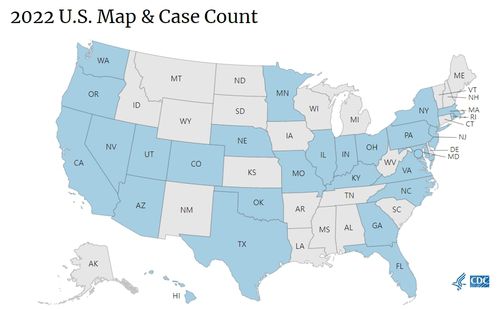 29일 기준 미국 주별 원숭이두창 확진발생 현황(파란색)[CDC 홈페이지 캡처. 재판매 및 DB 금지]