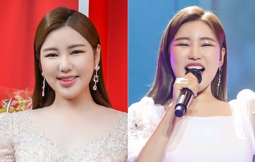 가수 송가인[포켓돌스튜디오 제공. 재판매 및 DB 금지]