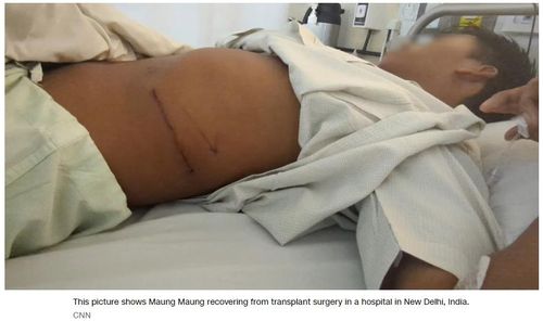 경제파탄 미얀마, 소셜미디어로 '장기 팔아요' 빈곤층 늘어미얀마인 마웅 마웅(가명)이 인도 뉴델리 한 병원에서 신장 한 쪽을 떼주는 수술을 받은 뒤 회복 중인 모습. 2025.08.31 [CNN 홈페이지 캡처. 재판매 및 DB 금지]