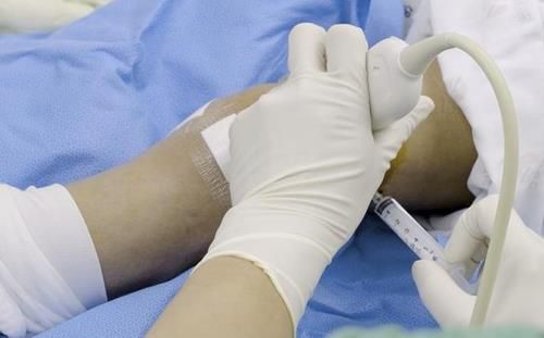 줄기세포 시술[연합뉴스 자료사진]