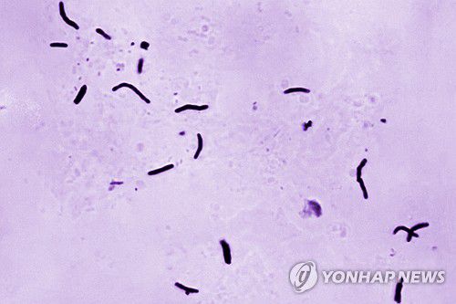 결핵균[미 질병통제예방센터(CDC)/AP=연합뉴스 자료사진]