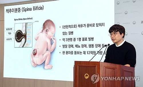 국내 연구진, 척추이분증의 유전적 원인 풀었다(세종=연합뉴스) 배재만 기자 = 연세대학교 의과대학 김상우 교수가 지난 25일 정부세종청사 과학기술정보통신부 기자실에서 선천성 척추이분증의 유전적 원인 규명과 관련한 설명을 하고 있다. 2025.3.27 scoop@yna.co.kr