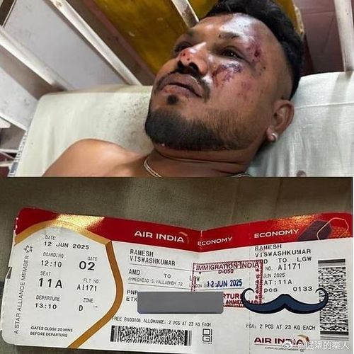 인도 여객기 추락사고의 유일한 생존자[웨이보 캡처. 재판매 및 DB금지]