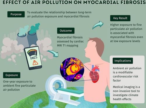 대기오염이 심근 섬유화에 미치는 영향 연구 개요. 심장 MRI 결과 초미세먼지(PM2.5)에 장기간 노출되면 확장성 심근병증 환자 및 정상인 모두 심근 섬유화(myocardial fibrosis) 증상이 증가하는 것으로 나타났다. [Radiological Society of North America(RSNA) 제공. 재판매 및 DB 금지]
