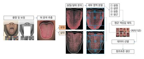 혀 영상 데이터 분석방법[한국한의학연구원 제공. 재판매 및 DB 금지]