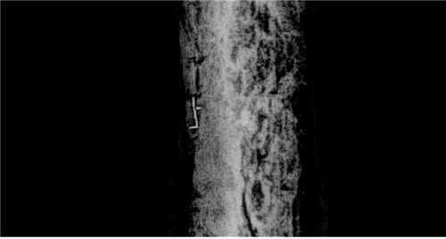 디지털 X-선 필름으로 확인된 글자 '上'[국립김해박물관 제공. 재판매 및 DB 금지]