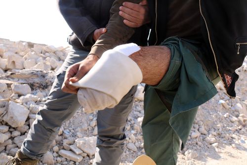 내전 끝난 뒤에도 위험 여전(하라스타=연합뉴스) 김동호 특파원 = 4일(현지시간) 13여년의 내전으로 폐허가 된 시리아 다마스쿠스 인근 하라스타의 한 주민이 다리 상처를 보이고 있다. 2025.12.4 dk@yna.co.k