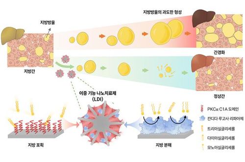 나노치료제의 이중 기능을 통한 지방간 개선[KIST 제공. 재판매 및 DB 금지]