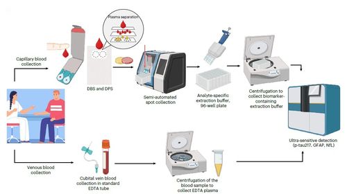 정맥 혈장과 손가락 끝 채취 혈액 건조 샘플을 이용한 알츠하이머병 생체표지 검사[Nature Medicine, Nicholas J. Ashton et al. 제공. 재판매 및 DB 금지]