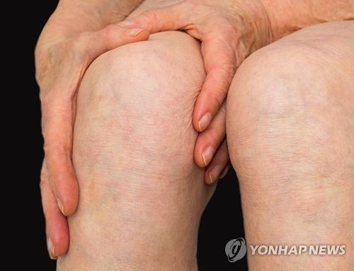 무릎 질환[게티이미지뱅크 제공]