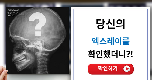 【충격!!】 당신의 엑스레이를 확인했더니!?