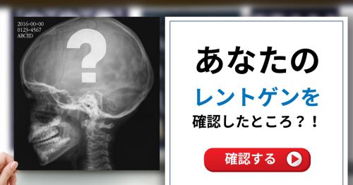 【衝撃!!】 あなたのレントゲンを確認したところ…!?