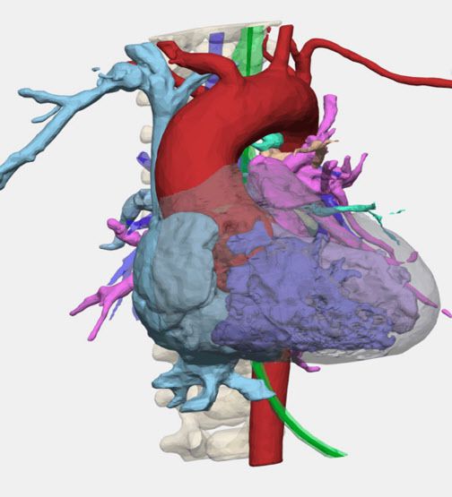 다쏘시스템의 버추얼휴먼 모델링 기술로 제시 레빈의 심장을 구현한 이미지(사진=다쏘시스템)