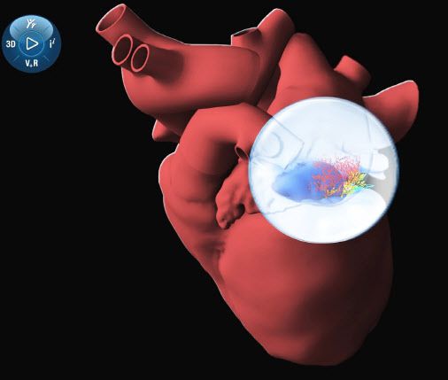 다쏘시스템의 버추얼휴먼 모델링 기술로 제시 레빈의 심장을 구현한 이미지(사진=다쏘시스템)