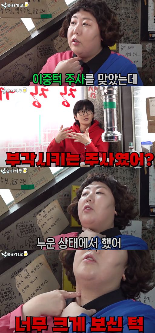 신기루가 이중턱 주사를 맞았던 일화를 얘기하고 있다 . 유튜브 채널 '뭐든하기루' 캡처