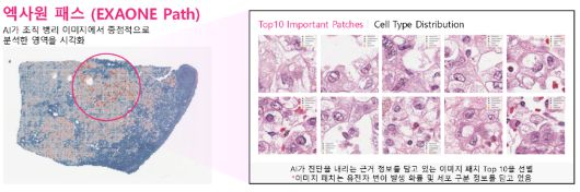 LG AI연구원의 차세대 정밀 의료 인공지능(AI) 모델인 엑사원 패스는 전체 슬라이드 이미지(WSI)에서 암과 관련된 유전자 변이를 예측할 수 있다. LG AI연구원 제공