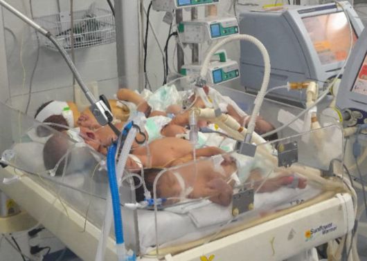 가자지구의 한 병원에서 연료와 장비 부족으로 4명의 신생아가 하나의 인큐베이터에 들어가 치료받고 있다. 파델 나임 엑스 계정