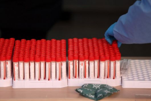 - 6일 서울역 코로나19 임시 선별검사소에 의료진이 빽빽하게 꽂힌 검체도구를 나눠주고 있다. 연합뉴스