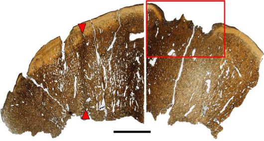CT 스캔에서 얻은 혈관 구조(위)와 회복된 흔적이 있는 골절 부위(아래) 그림=잭 호너와 마크 굿윈
