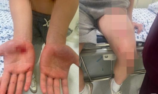 의정부시 ‘흉기 난동범’으로 오해받은 10대 중학생이 사복 경찰들의 무리한 진압으로 전신 찰과상을 입는 등 피해 봤다는 주장이 나왔다. 온라인 커뮤니티 캡처