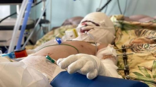 지난해 7월 사경을 헤매던 로만 올렉시우 모습.