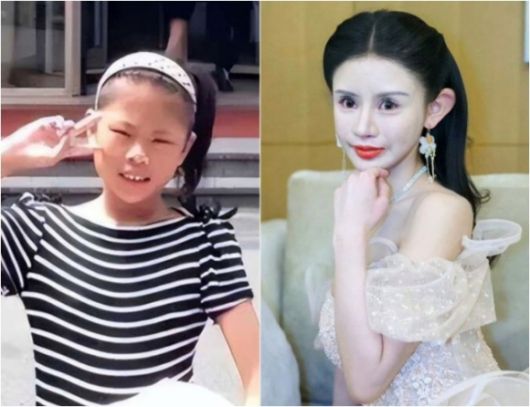 성형을 받기 전 저우추나의 모습(왼쪽)과 100번 넘는 성형을 한 그의 현재 모습(오른쪽). 사우스차이나 모닝포스트(SCMP) 캡처