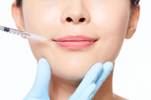 성형수술 자료 이미지. 기사와 직접적인 관련 없음. 아이클릭아트