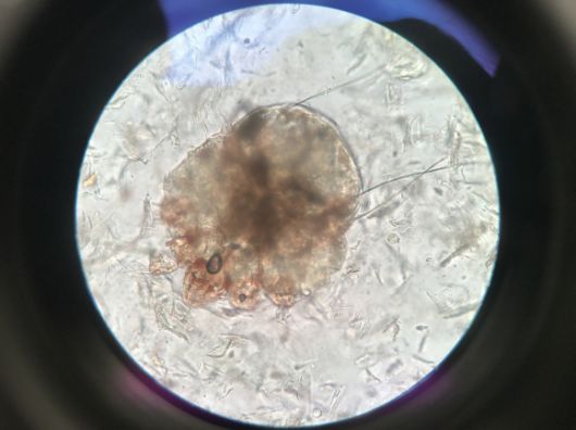 개선충(옴진드기·Sarcoptes scabiei).서울시야생동물센터 홈페이지