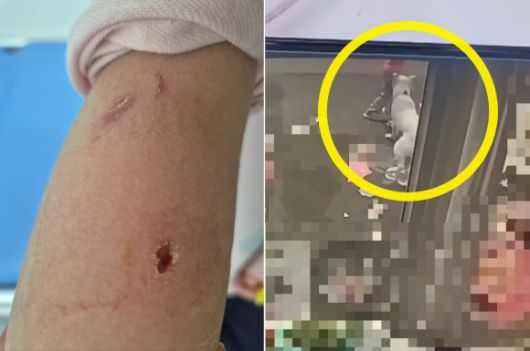 전북 지역 한 카페에서 초2 여아가 개 물림 사고를 당한 가운데 견주가 “아이가 개를 먼저 자극했다”고 주장하고 있다는 피해 여아 부친의 주장이 나왔다. 오른족 사진은 카페에 묶여 있던 개가 콩콩 뛰고 있던 여아에게 달려가 무는 장면(사진 일부 모자이크 처리함). 온라인 커뮤니티 ‘보배드림’ 캡처