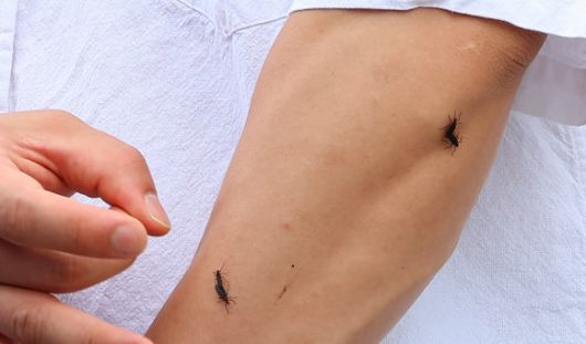 장마가 시작되며 서울과 인천, 경기 등 수도권에 러브버그(붉은등우단털파리)가 기승을 부리고 있는 가운데 27일 인천 서구 신검단중앙역에서 열린 인천도시철도 1호선 검단연장선 개통기념식장에서 한 시민이 몸에 붙은 러브버그를 떼어내고 있다. 연합뉴스