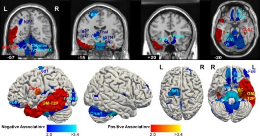 정신병질과 뇌 구조의 연관성을 나타낸 연구 첨부 자료. 출처=유럽 정신의학·임상신경과학 아카이브