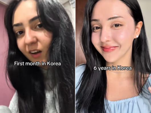 한국에 거주하는 한 외국인 여성이 지난 5월 자신의 채널에 올린 짧은 영상 속 한국 생활 전후 비교 모습. 이 영상은 조회수 480만건을 기록했다. 틱톡 채널 ‘beautywithsena’ 캡처