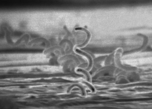 매독 원인 병원체인 트레포네마 팔리둠(Treponema pallidum)균 관련 이미지. 미국 질병통제예방센터(CDC) 공중보건이미지라이브러리