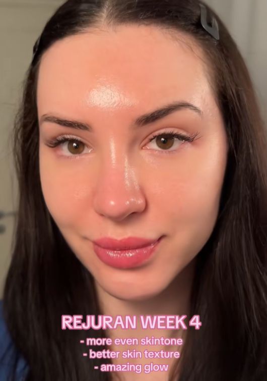 K뷰티가 전 세계적으로 인기를 끌고 있는 가운데, 최근 미용 시술을 받기 위해 한국에 오는 미국 여성들이 늘고 있는 것으로 알려졌다. 틱톡 캡처