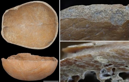 중국 신석기 시대 문명인 ‘량주 문화’ 유적지에서 발굴된 사람 두개골 유물 중 인위적으로 가공한 흔적과 함께 ‘바가지’ 형태로 가공된 두개골 2점. 사이언티픽 리포트 캡처