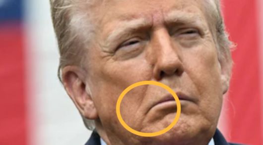 미국 현지시간으로 지난 9월 11일 미국 버지니아주(州) 알링턴에 있는 펜타곤에서 열린 9·11 테러 24주기 추모식에 참석한 트럼프 대통령. 오른쪽 입꼬리가 축 처진 모습이 역력하다. AFP 연합뉴스