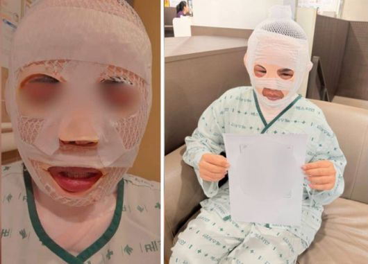 서울의 한 병원에서 치료 중인 태국 여성 A씨가 얼굴 전체에 붕대를 감은 채 앉아 있다. 그는 잠든 사이 한국인 남편이 얼굴에 끓는 물을 부어 중화상을 입은 것으로 알려졌다. 사진=페이스북