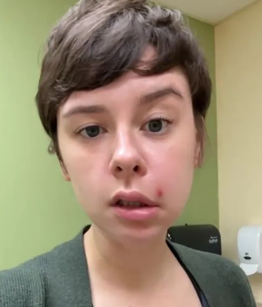 ‘죽음의 삼각형’으로 불리는 얼굴의 특정 부위에 난 여드름을 건드렸다가 심각한 감염에 걸릴 뻔한 한 여성의 사연이 알려지며 눈길을 끌고 있다. 틱톡